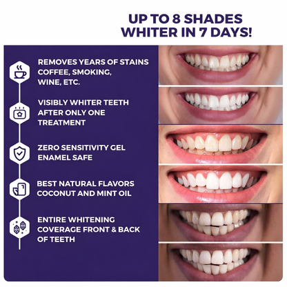 GlowVera Dental Teeth Whitening Strips